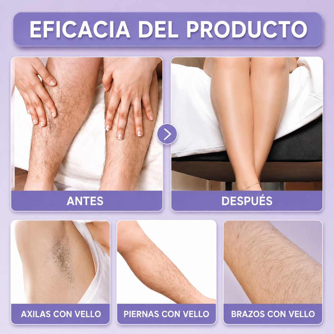 SHPYNX™ - Depiladora Portátil 3 en 1