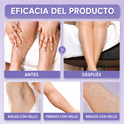 SHPYNX™ - Depiladora Portátil 3 en 1